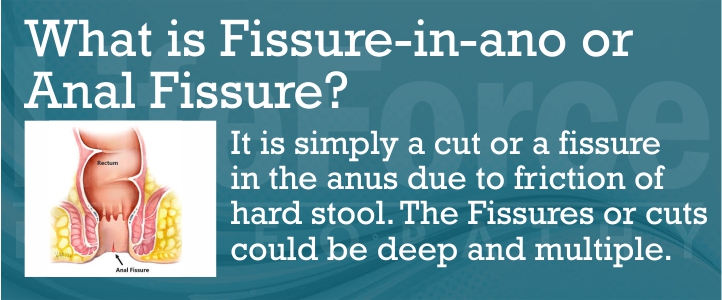 what is fissure-in-ano